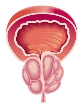 Symptoms of prostatitis in men.