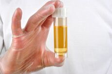 Urinalysis is one of the methods for diagnosing prostatitis. 